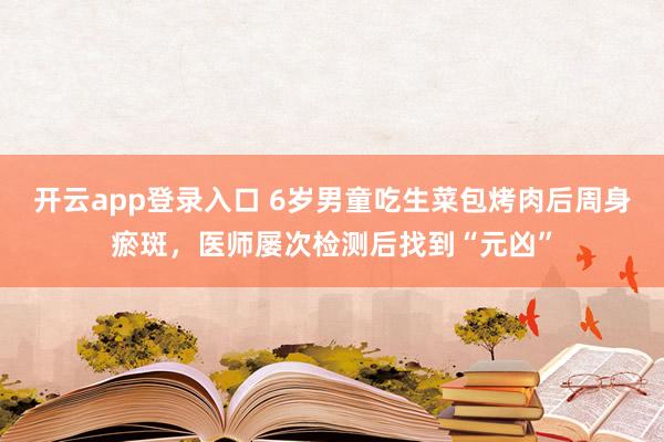 开云app登录入口 6岁男童吃生菜包烤肉后周身瘀斑,医师屡次检测后找到“元凶”